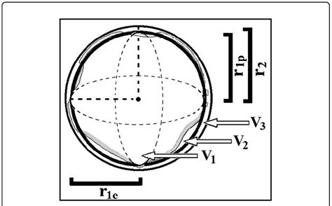 Demonstration of sea level change. Grey line indicates the geoid shape ...