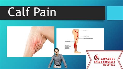 What Deficiency Causes Calf Pain? Exploring The Link