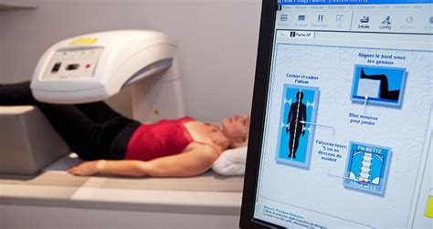 Bone Density Test, Osteoporosis Screening & T-score Interpretation