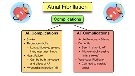 Atrial Fibrillation: Symptoms, ECG, Causes, Treatment, Definition ...