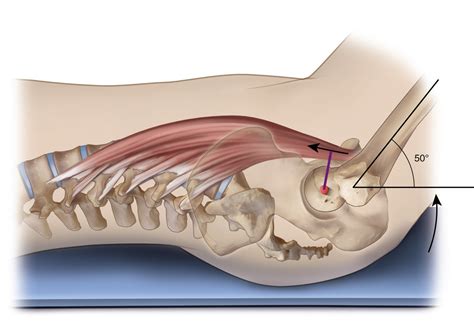 Psoas Major Function: Introduction Muscle Biomechanics, 43% OFF