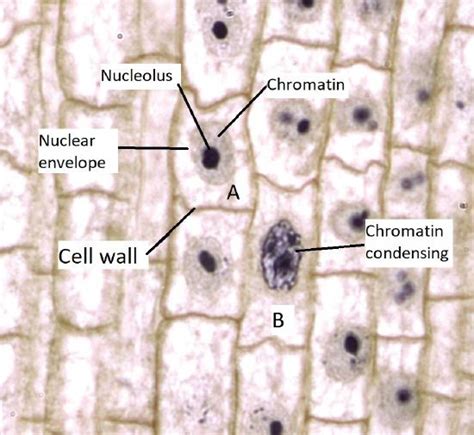 Onion Root Cell Mitosis Labeled - Juventu dugtleon