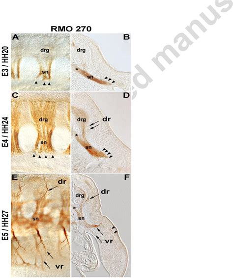 Figure 1 from Engrailed controls epaxial-hypaxial muscle innervation ...