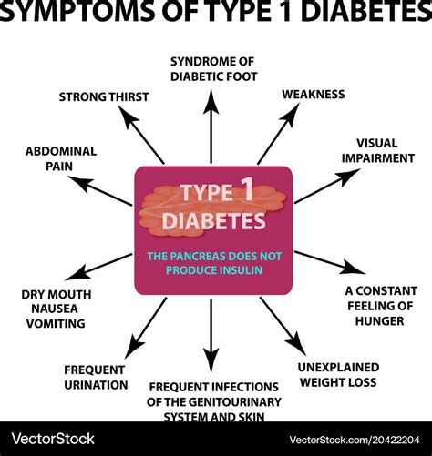 Symptoms type 1 diabetes infographics Royalty Free Vector