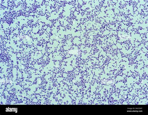 Light micrograph of Corynebacterium diphtheria gravis, a Gram positive ...