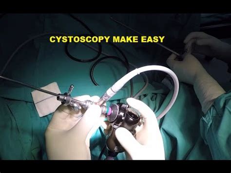 Cystoscopy Set at Best Price in India