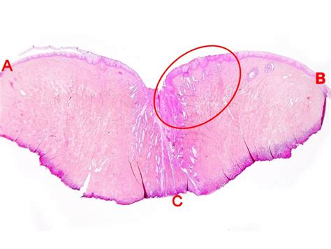 Endocervix Histology