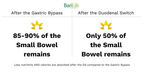 Duodenal Switch Surgery, Is It Better Than VSG and Bypass?