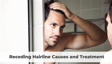 Receding Hairline Causes and Treatment | Hair to Ware