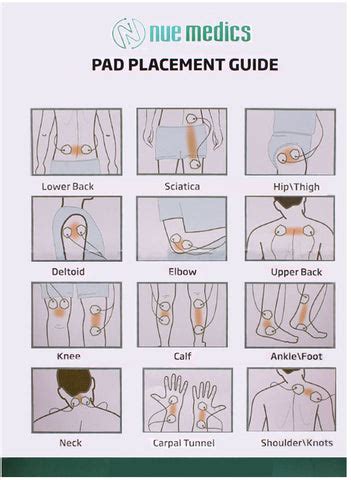 Tens Electrode Placement Chart.pdf