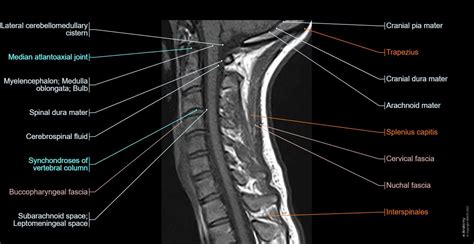 Cervical spine MRI: normal anatomy | e-Anatomy