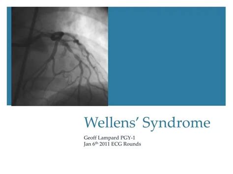 PPT - Wellens ’ Syndrome PowerPoint Presentation - ID:6938565