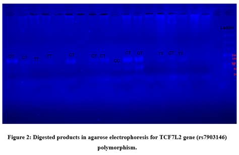 Association of Transcription Factor 7 Like 2 (TCF7L2) ( rs7903146) Gene ...