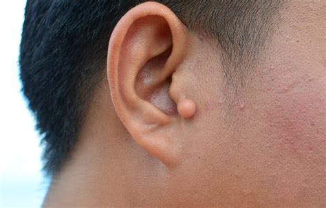 Clinical images challenge: ear disorders | OnMedica