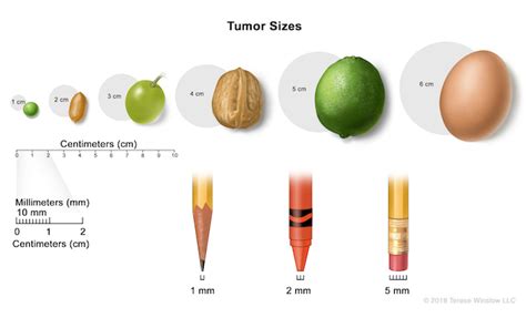 Tumor Size Chart In Mm | Hot Sex Picture