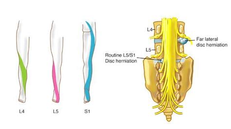 Why is my big toe numb? - Acupuncture , Dry Needling, Prolotherapy in ...