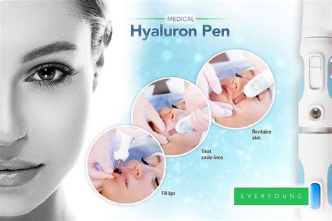 Hyaluron Pen Treatment Australia - Shaws Bay Beauty