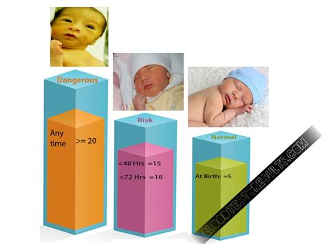 Updated: Jaundice Levels Chart in Newborns (Jaundice Levels 5,12,15,18 ...