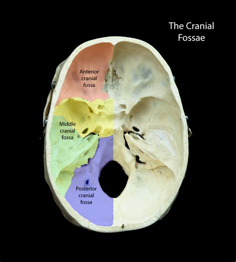 Middle Cranial Fossa