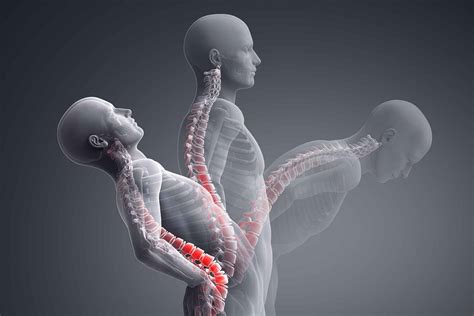 Lumbar Spine Facet Joint Dysfunction and Pain | Blackberry Clinic