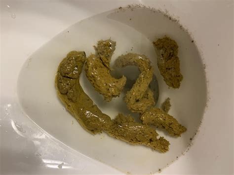 Warning Poop: does this look like fatty stool? Normal diet and fecal ...