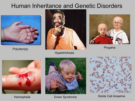 Human Inheritance & Genetic Disorders