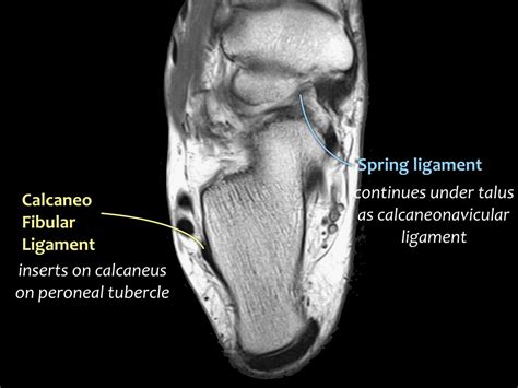 mri ankle anatomy