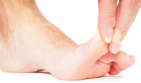 Why is my big toe numb? - Stemulus Innovative Healthcare