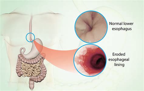 Health Condition : Symptoms, Causes, Treatment and More