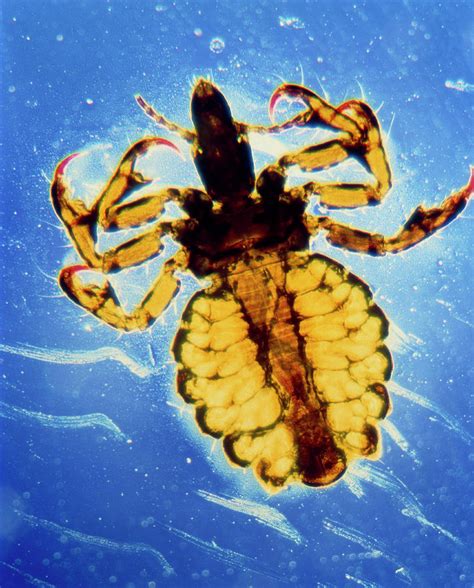 Lm Of Human Body Louse Photograph by Stevie Grand/science Photo Library ...