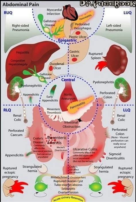 Diagnosis: Nursing Diagnosis For Abdominal Pain