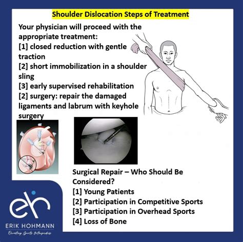 Shoulder Dislocation Steps of Treatment - Sports Injury specialist in Dubai