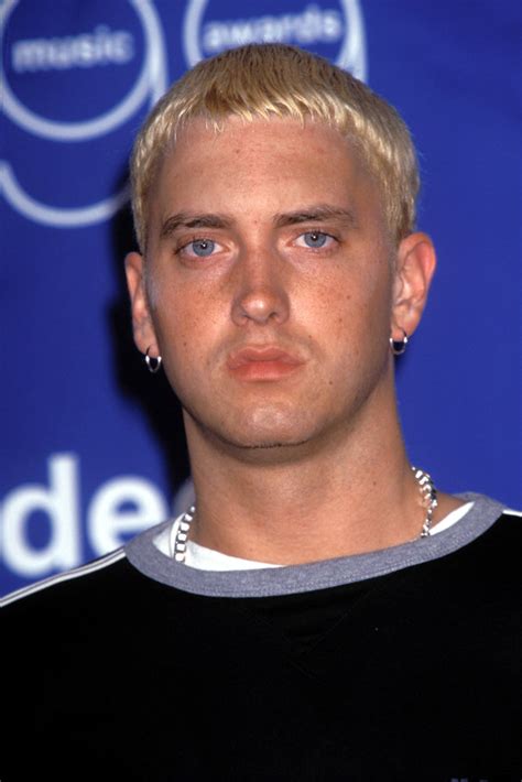 Eminem/marshall Mathers Hair Loss Thread | HairLossTalk Forums