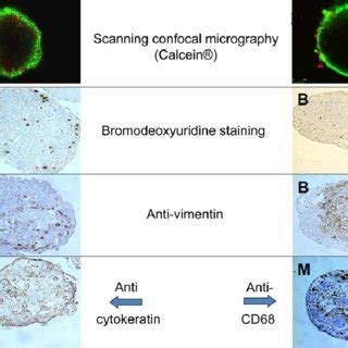 Spheroid staining. The upper three picture rows show consecutive ...