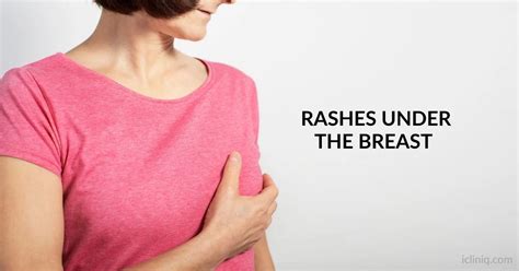 Breast Cancer Rash: Signs, Causes, and Strategies for Detection