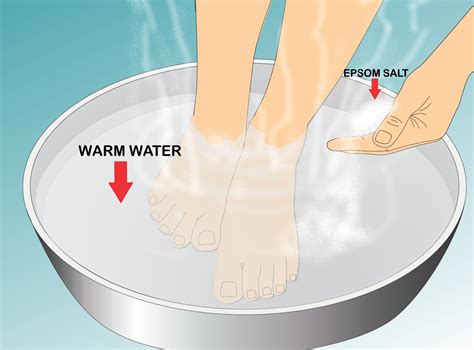 How to Remove an Ingrown Toenail (with Pictures) - wikiHow