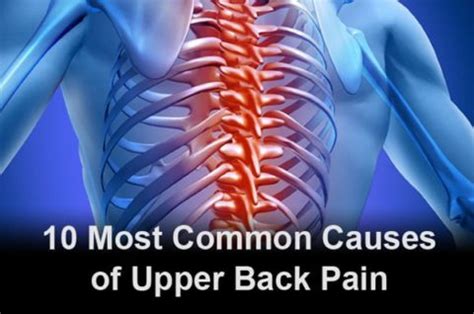 10 Most Common Causes of Upper Back Pain | Why Your Upper Back Hurts