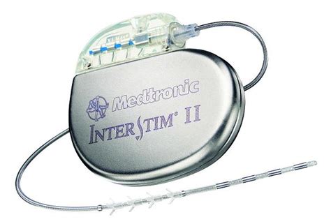 Bladder pacemaker urgently needed for overactive bladder | Total Health