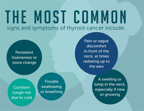 Thyroid Cancer: Symptoms and Signs | Dana-Farber Cancer Institute