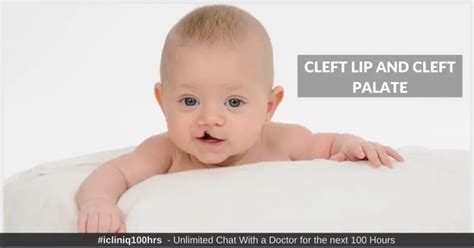 Cleft Lip and Cleft Palate - Causes | Symptoms | Diagnosis | Treatments