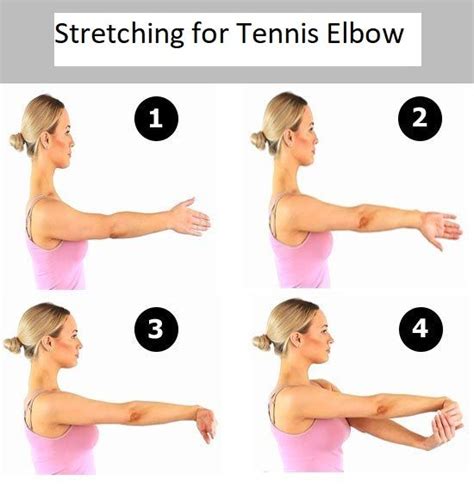 Lateral epicondylitis tennis elbow causes symptoms treatment – Artofit