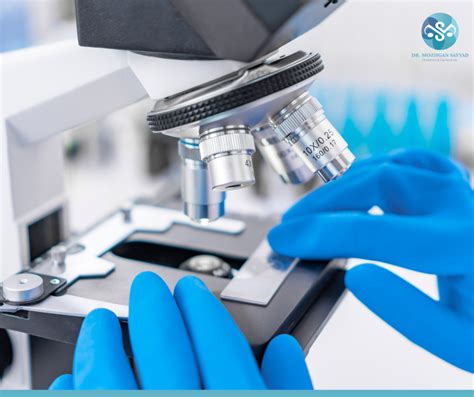 ASCUS – Understanding Abnormal Pap Smear Results