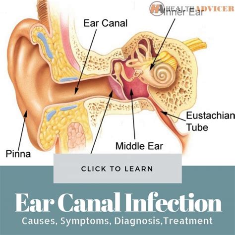 Ear Canal Infection: Causes, Picture, Symptoms, And Treatment