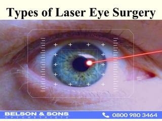 Types of Laser Eye Surgery | PPT