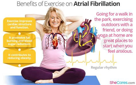 Atrial fibrillation prevention – Artofit