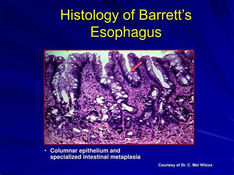 Histology Esophagus Histology Slides Biomedical 3196 | The Best Porn ...