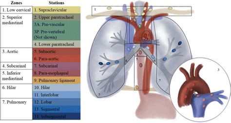 Mediastinal Lymph Nodes