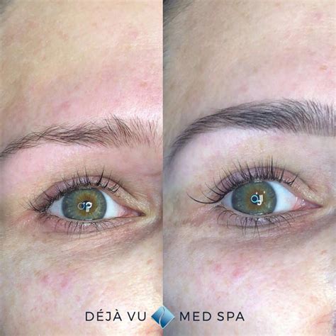 Lash Lift - Deja Vu Med Spa - Lash Lift Near Me Treatment