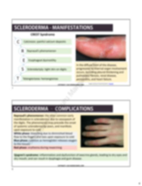 SOLUTION: Connective tissue disorders - Studypool