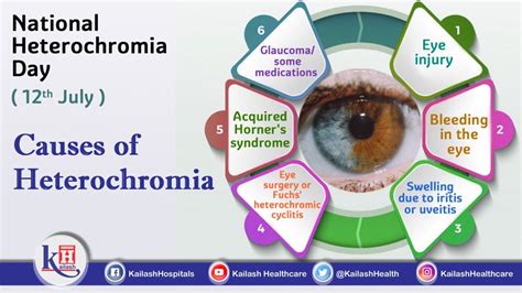 National Heterochromia Day (12th July 2020)